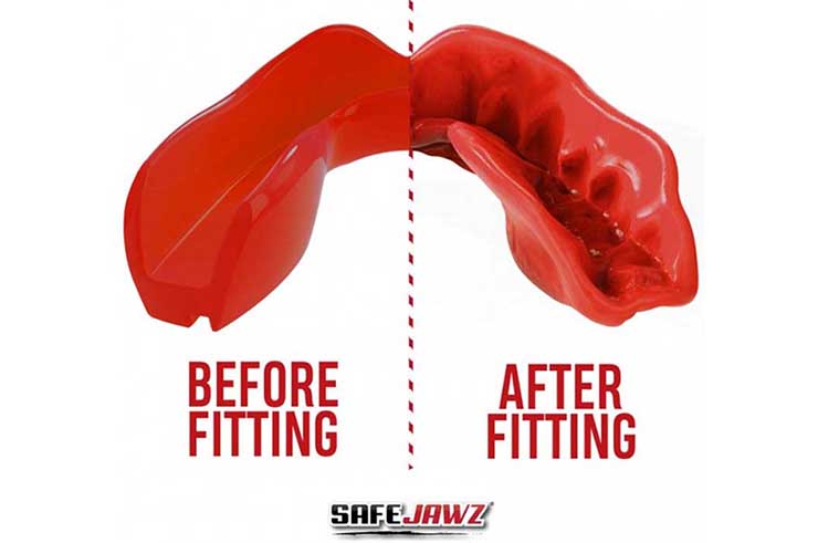 Single mouthguard, Thermoformable - Intro-Series, Safe Jawz