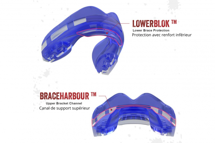 Single Mouthguard, Thermoformable - Ortho Series, Safe Jawz